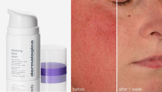 New stabilizing repair cream helps put a stop to sensitive skin